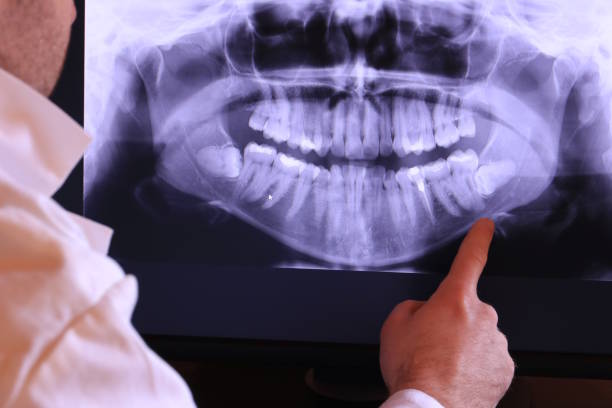 Best Emergency Treatment for Toothache in Versailles, IN