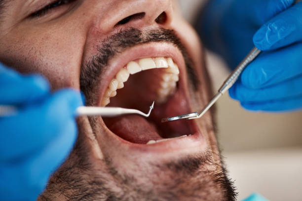 Best Emergency Dental Care for Trauma or Injury in Versailles, IN